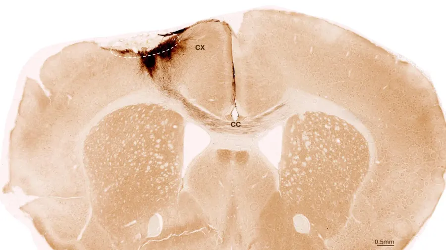 Stem cells reverse stroke damage in mice