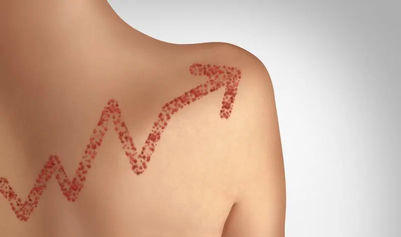 US measles cases hit 4,588, more than double last year