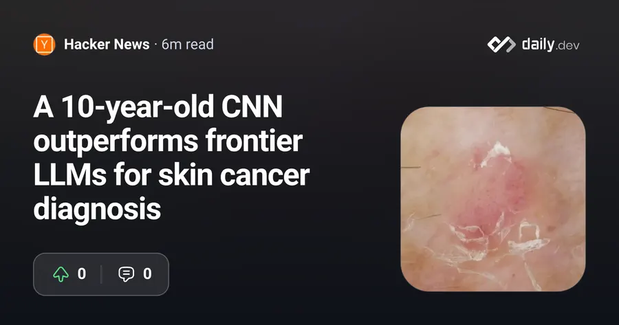 10-year-old CNN beats frontier LLMs on skin cancer